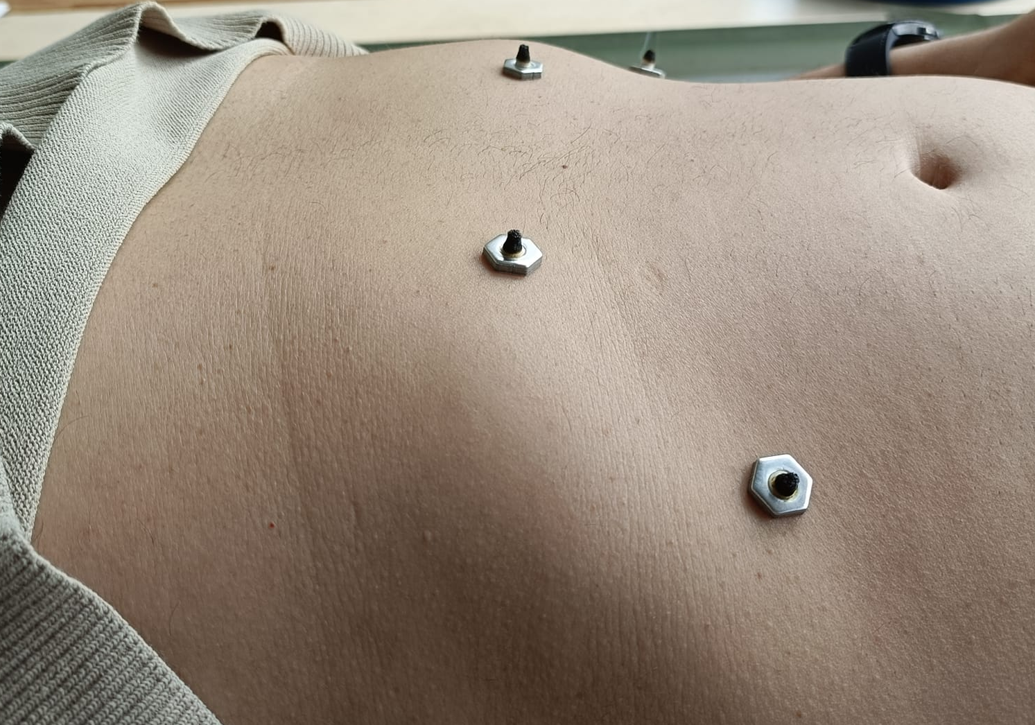 moxabustion japonesa3